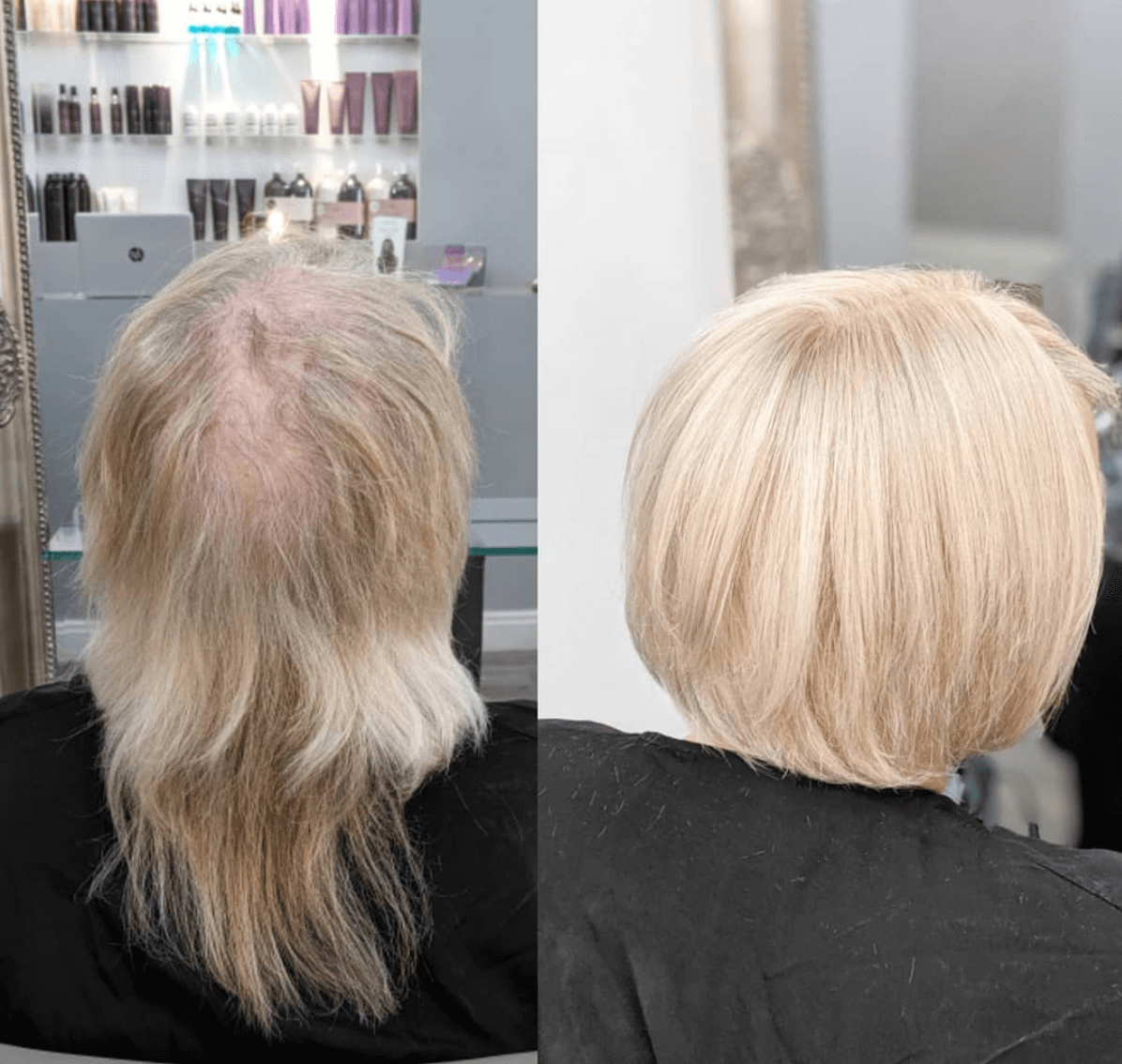 hair treatment thinning